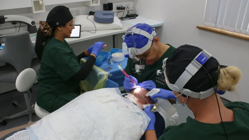 The hair transplant timeline, month by month