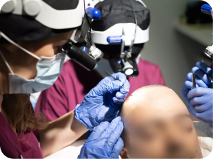Hair Transplant Repairs