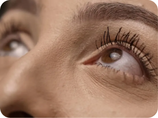 Eyelash Transplant Surgery