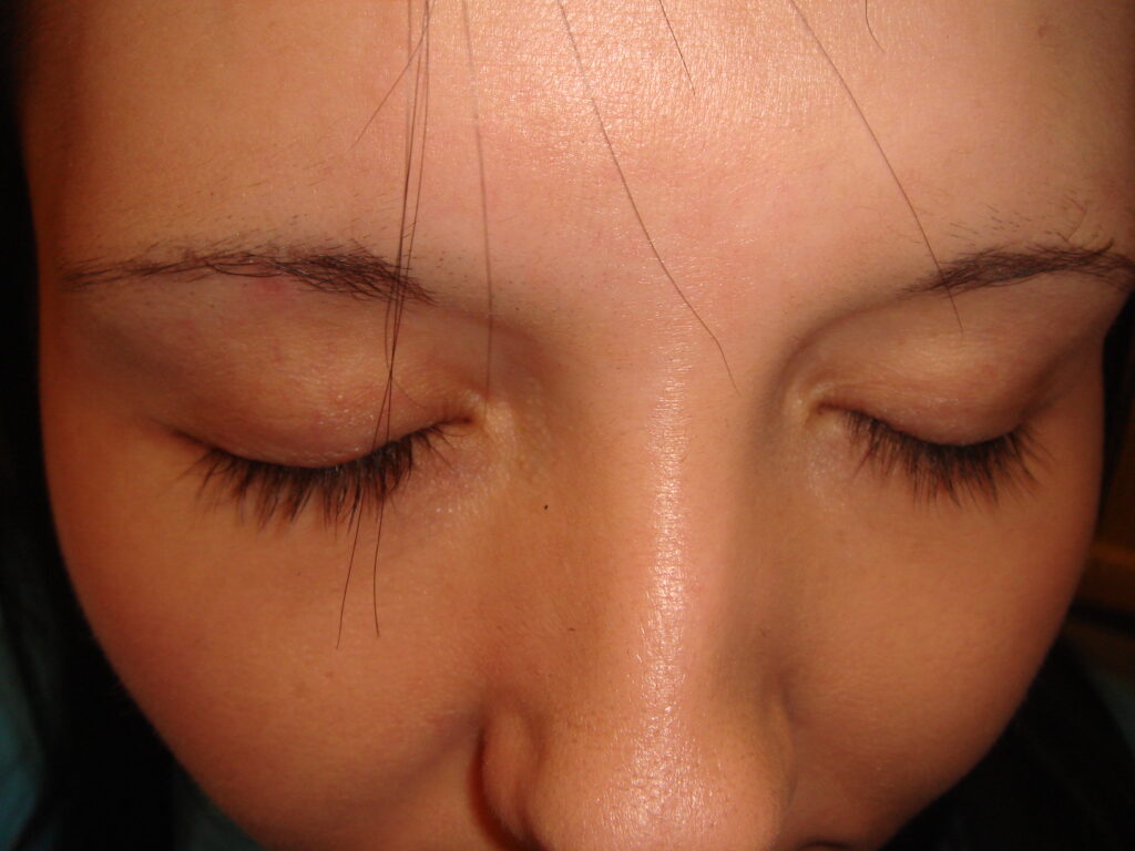 Eyelash 1 - after treatment